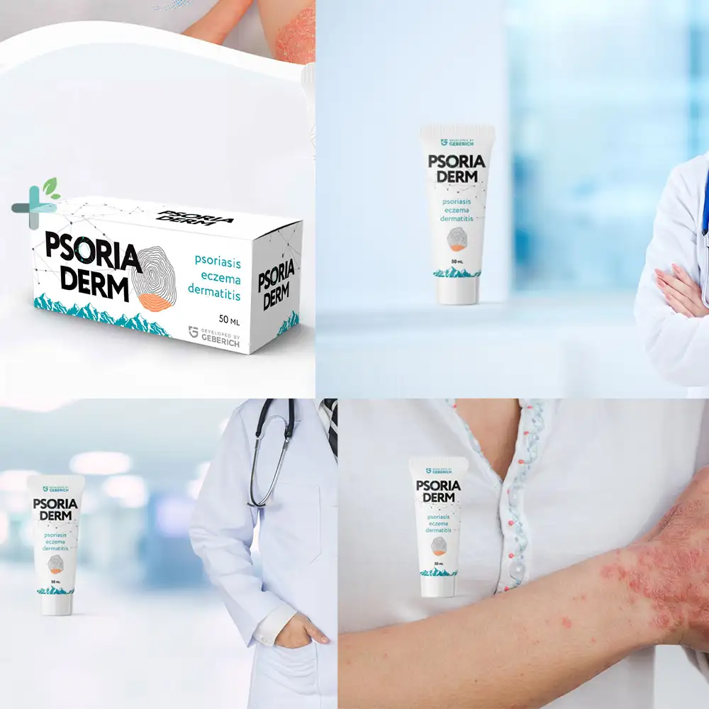 Psoriaderm: Líder en Terapia Transformadora de la Piel