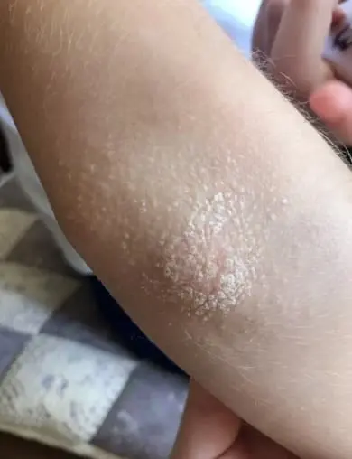 Cómo aplicar la Crema Dr. Derm: Uso adecuado